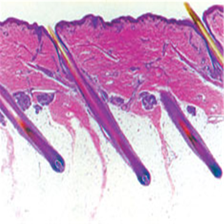人皮肤切片（示毛囊）