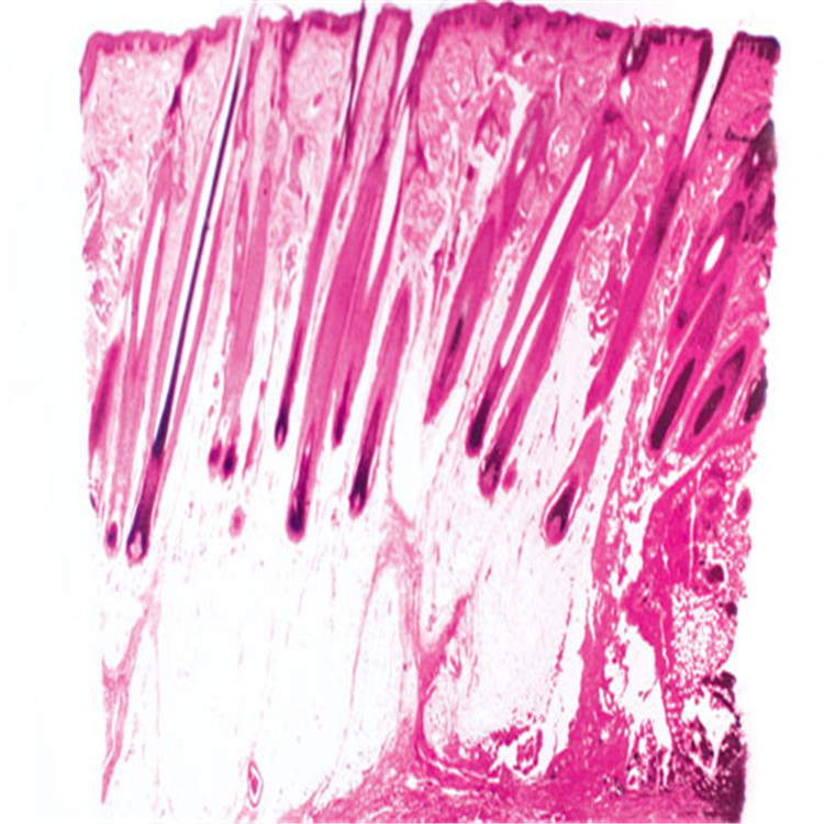 人皮肤切片示毛囊