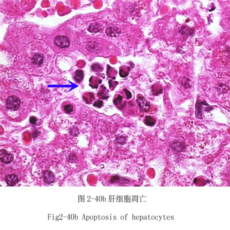 肝细胞凋亡