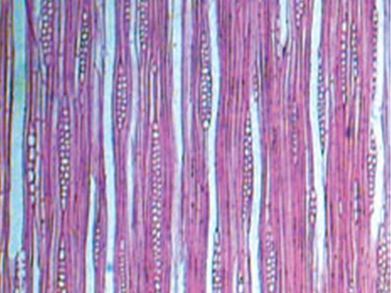 杜仲维管形成层装片（示非叠生）